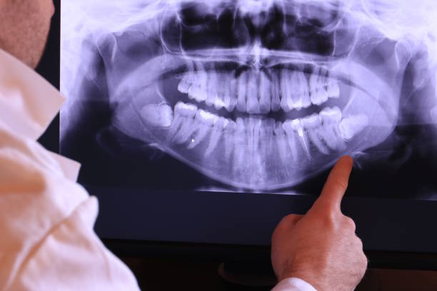 Urgent Tooth Repair in OH