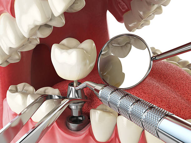 Best Urgent Tooth Repair  in Painesville, OH